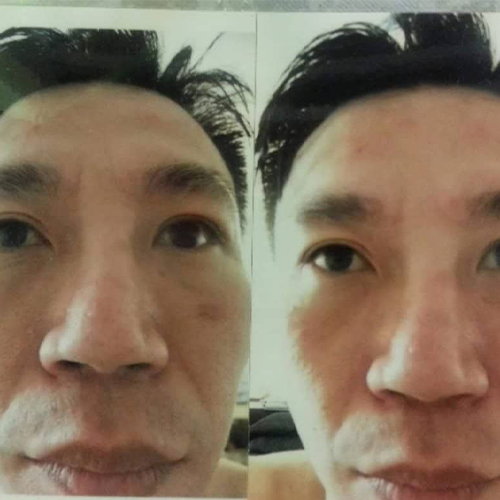 facial effect after using plan and product