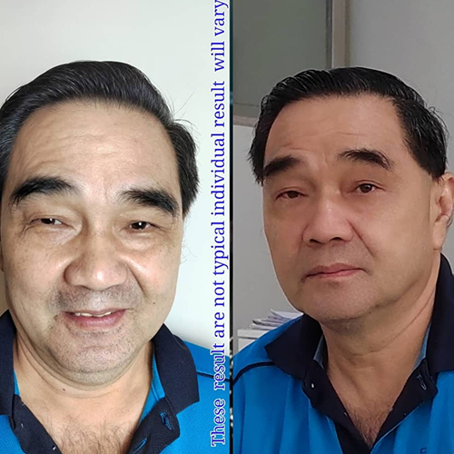 56 year old uncle facial look younger after follow coach